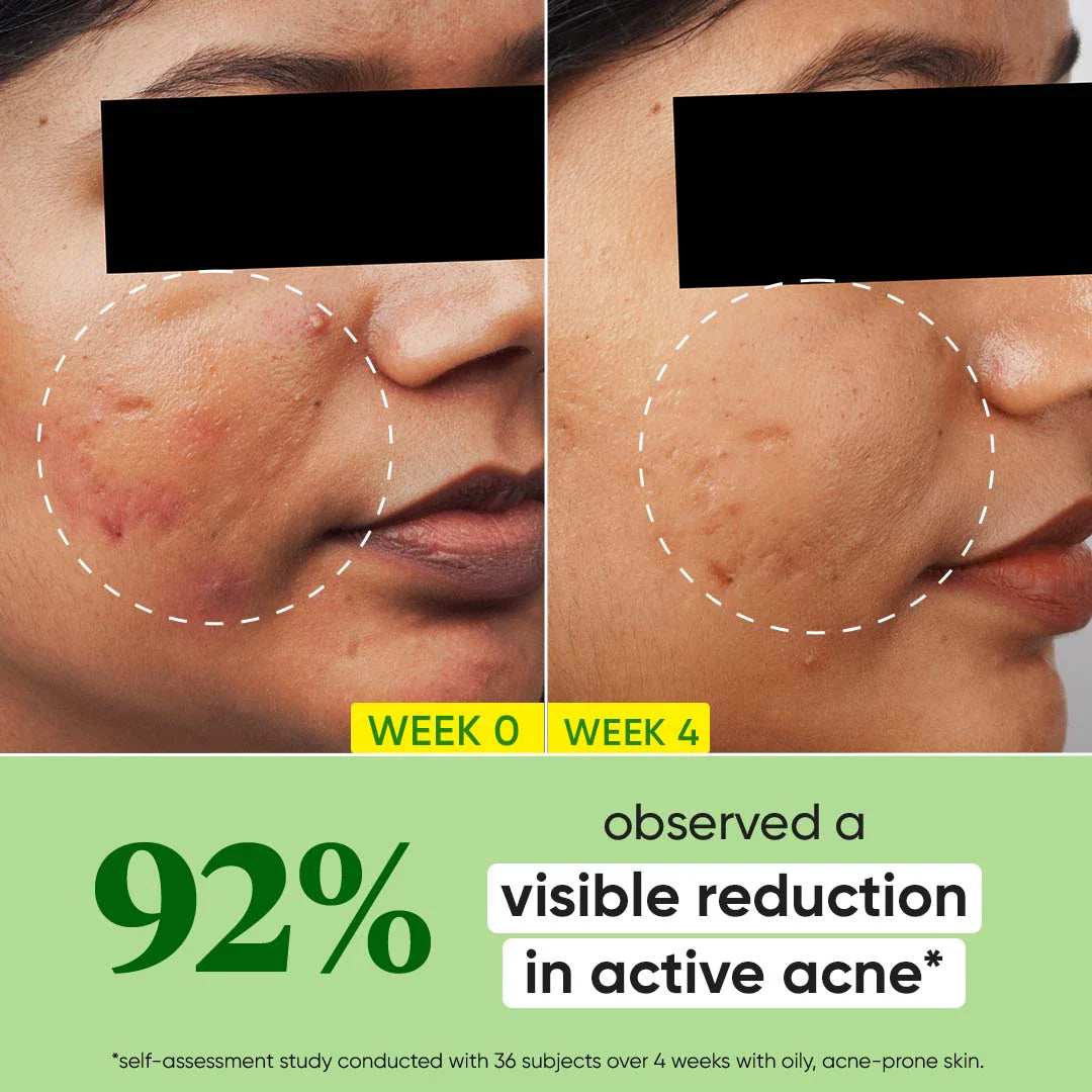 DOT & KEY CICA & CACTUS 2% SALICYLIC + ZINC SKIN CLEARING SERUM 30ML