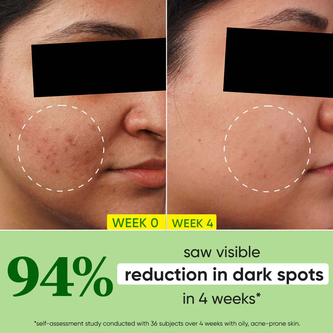 DOT & KEY CICA + 10% NIACINAMIDE SPOT REDUCTION FACE SERUM 30ML