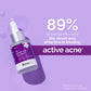 The Derma Co 2% Salicylic Acid Face Serum for Acne & Acne Marks - 30 ml(dermaco)