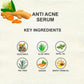 Love Earth Anti Acne Face Serum - 30ml